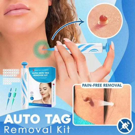Auto tag removal kit
